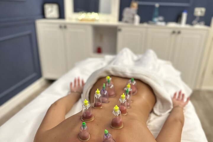 Cupping Therapy  - Photo 1 of 8